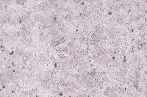 Astor 106-02
